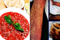 Nhiều người suýt chết sau ăn tiết canh: Phòng tránh thế nào?