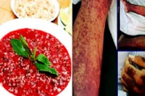 Nhiều người suýt chết sau ăn tiết canh: Phòng tránh thế nào?