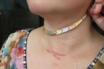 Đeo trang sức khi đi tập thể dục buổi sáng: Hiểm họa rình rập! 