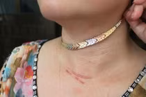 Đeo trang sức khi đi tập thể dục buổi sáng: Hiểm họa rình rập! 