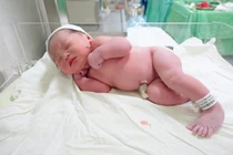 Bé gái chào đời cùng vòng tránh thai của mẹ