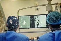 Ù tai, đỏ mắt không ngờ rò động mạch cảnh xoang hang sau tai nạn