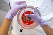 Phương pháp đông lạnh thận chờ ghép trong 10 ngày vẫn hoạt động bình thường