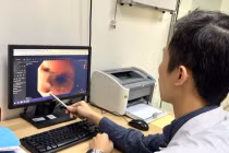 Đang chơi đùa, bé gái 11 tuổi bị chó nhà cắn thủng thực quản