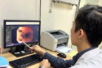 Đang chơi đùa, bé gái 11 tuổi bị chó nhà cắn thủng thực quản