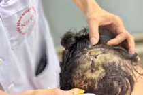 Bé gái 5 tuổi bị chó lớn trong nhà tấn công 10 vết thương vào đầu