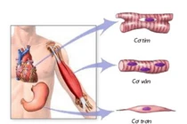 Cẩn thận biến chứng tiêu cơ vân sau chấn thương có thể gây suy đa tạng
