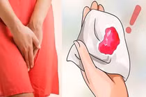 Ra máu sau 7 năm mãn kinh, người phụ nữ 55 tuổi phát hiện ung thư niêm mạc tử cung - Ảnh minh họa 