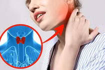 Bệnh tuyến giáp ổn định vẫn có thể phẫu thuật, sinh con 