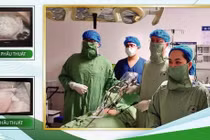 Nội soi bảo tồn cứu thai phụ 7 tuần bị xoắn buồng trứng