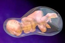 Sản phụ mất con do cạn ối sinh non: Ối cạn, cách nào dưỡng, giữ thai?