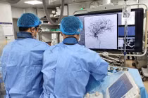 Hết liệt nửa người do đột quỵ nhờ can thiệp mạch máu não kịp thời