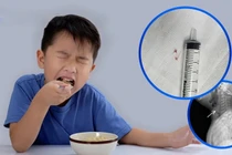 Trẻ 16 tháng tuổi hóc xương cá nguy hiểm vào đường thở, cách gì phòng tránh?