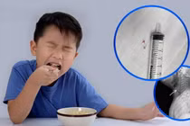 Trẻ 16 tháng tuổi hóc xương cá nguy hiểm vào đường thở, cách gì phòng tránh?