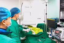 Triệt đốt ổ loạn nhịp tim bằng sóng RF