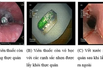 Thận trọng khi uống thuốc để tránh nhập viện cấp cứu vì nuốt cả vỏ thuốc