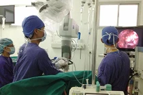 Những bệnh viện điều trị tốt u não tại Hà Nội