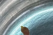 Bắt 3 con sán lá gan nhỏ trong ống mật chủ bệnh nhân 57 tuổi