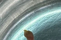 Bắt 3 con sán lá gan nhỏ trong ống mật chủ bệnh nhân 57 tuổi