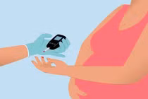 Hiếm gặp: đái tháo tháo type 1 thể tối cấp ở thai phụ