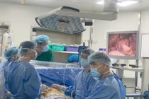 U nhầy ở tim - căn bệnh lành tính nhưng nguy hiểm