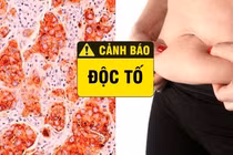 Dấu hiệu cho thấy cơ thể cần thải độc tố