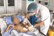 Mắc nấm hiếm gặp, người đàn ông bị hoại tử vùng ngực phải mổ 3 lần