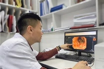 Hẹp trực tràng, nghi ung thư sau tiêm xơ trĩ tại phòng khám tư