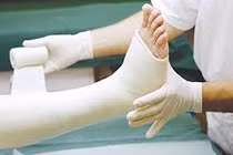 Bác sĩ mách cách theo dõi bó bột tránh biến chứng nguy hiểm