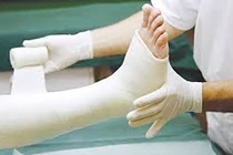 Bác sĩ mách cách theo dõi bó bột tránh biến chứng nguy hiểm