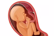 Mạch máu tiền đạo có sinh thường được không?