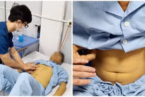 Ăn nấm tự nhiên, nhiều người ngộ độc, suy gan thận nặng