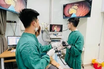 Đầy bụng, chán ăn, cụ bà 65 tuổi không ngờ bã thức ăn đầy dạ dày