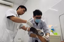 Thợ điện 37 tuổi thoát chết thần kỳ sau điện giật tay phải cháy đen