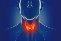 Cơn bão giáp trạng là gì mà tỷ lệ tử vong gần 100%