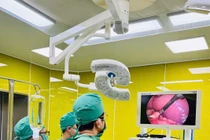 Chủ quan viêm loét dạ dày, người đàn ông bị sốc do thủng môn vị