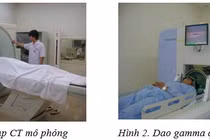 Xạ phẫu bằng dao gamma quay: Giải pháp đột phá trong điều trị u não