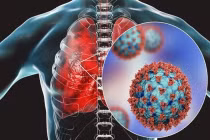 Virus HMPV gây viêm phổi đang lây lan ở Trung Quốc nguy hiểm thế nào?