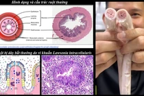 “Tác nhân” tạo lòng se điếu ở heo là do bị bệnh?