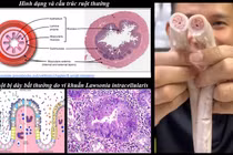 “Tác nhân” tạo lòng se điếu ở heo là do bị bệnh?