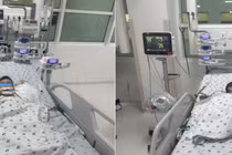 Trẻ 1 tuổi ngã từ giường xuống nền nhà vỡ khí quản