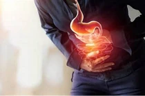 Nhận biết sớm để tránh biến chứng nguy hại của rối loạn tiêu hóa