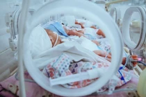 Trẻ sinh non có nguy cơ viêm ruột hoại tử đe dọa tính mạng