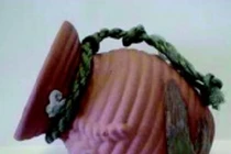 Hội chứng “Trái tim tan vỡ” sau chấn thương sọ não nặng