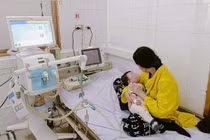 Trẻ 7 tháng tuổi viêm phổi, suy hô hấp cấp do sởi biến chứng nặng