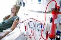 Cẩn thận tai biến nghiêm trọng khi “lọc máu” làm đẹp, ngừa đột quỵ, ung thư...