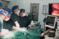 Phẫu thuật khẩn cấp giãn não cho chàng trai 22 tuổi bị lao toàn thể rò thực quản