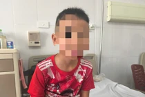 Cú ngã vô tình giờ chơi, trẻ 8 tuổi phát hiện bệnh hiếm gặp ở phổi