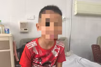 Cú ngã vô tình giờ chơi, trẻ 8 tuổi phát hiện bệnh hiếm gặp ở phổi