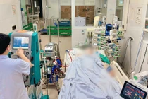 Can thiệp ECMO, thay huyết tương cứu người phụ nữ chảy máu phổi dữ dội